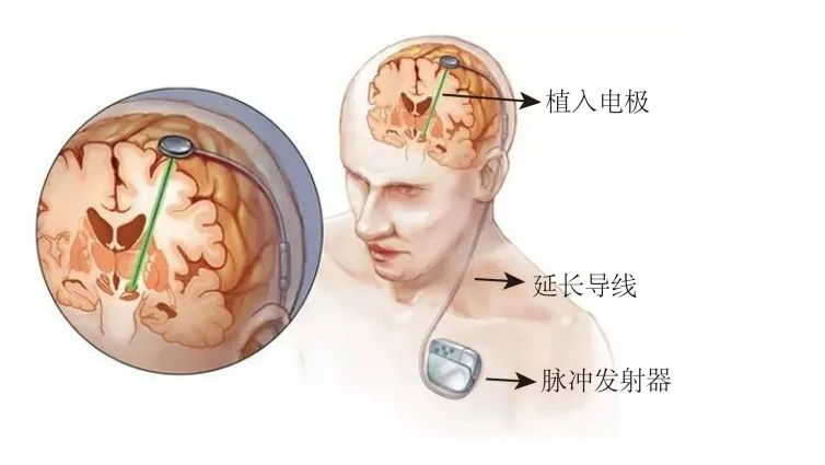 72918b4f43603cf98380af6a3aebb963